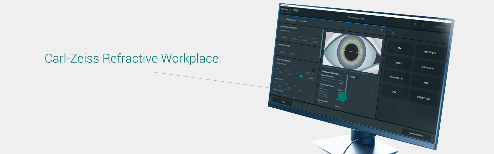 Carl Zeiss Refractive Workspace